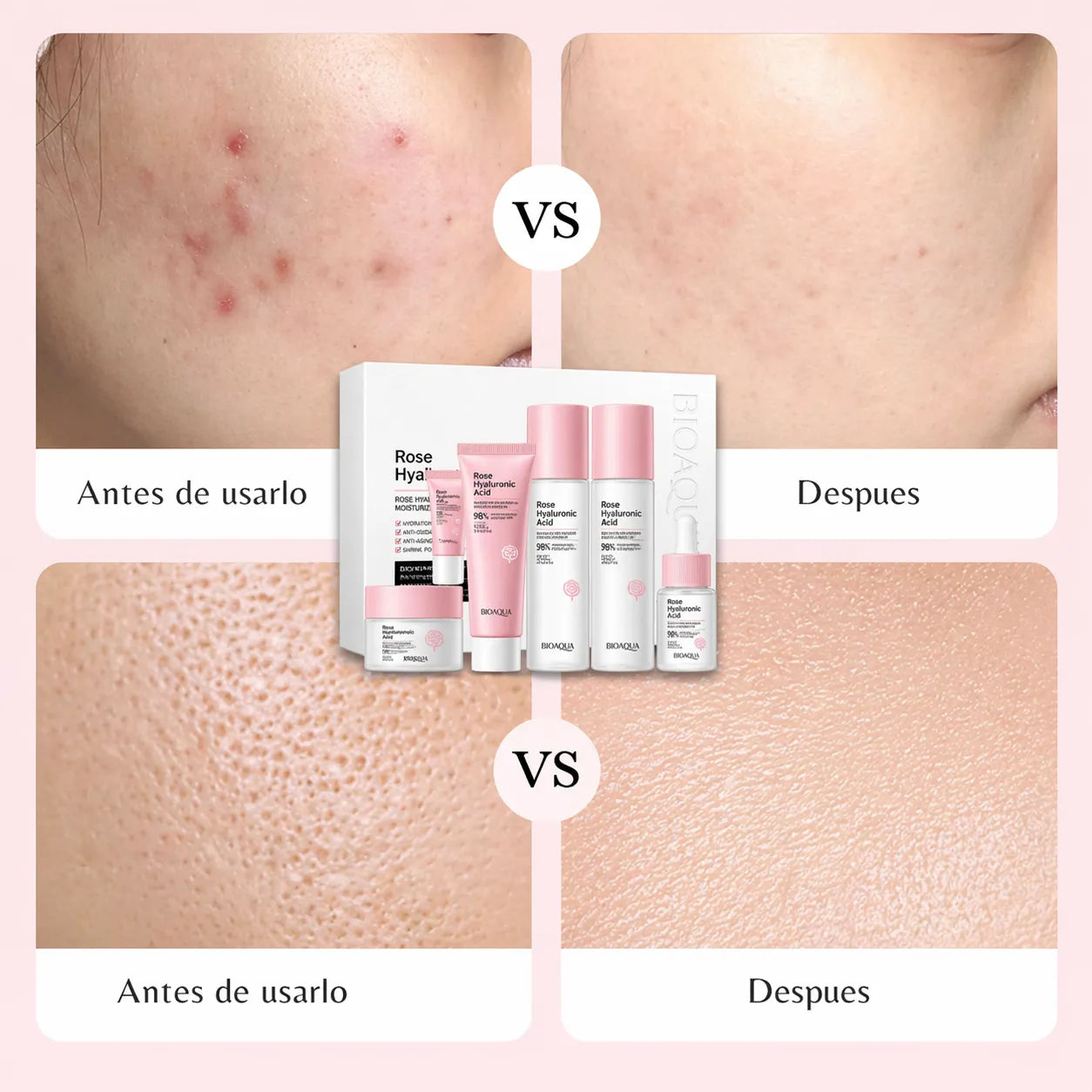 💖 Kit Rose Hyaluronic Acid 6 en 1 + Envío Gratis 🎁 El Regalo Perfecto