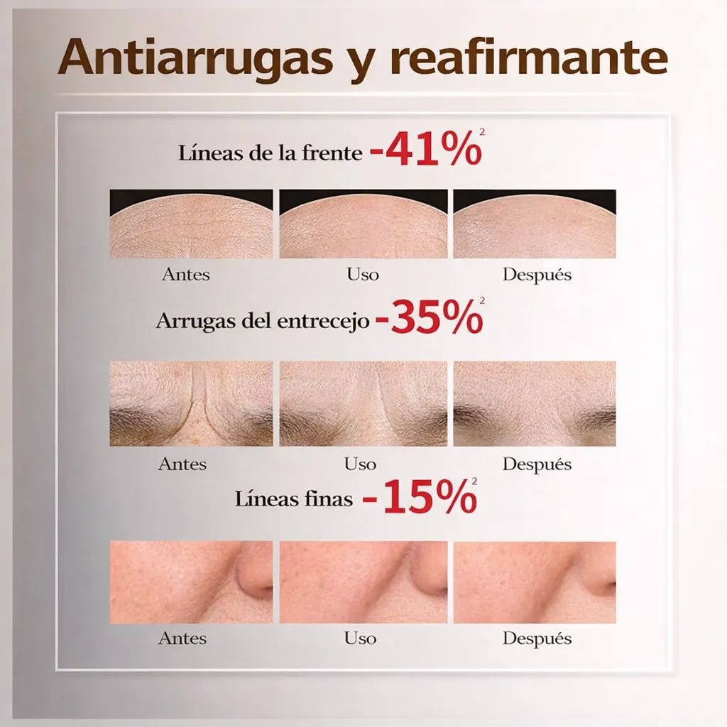 🔥 Crema Botox de Veneno de Abeja 2x1 + E-book GRATIS 🚚 Envío Gratis HOY
